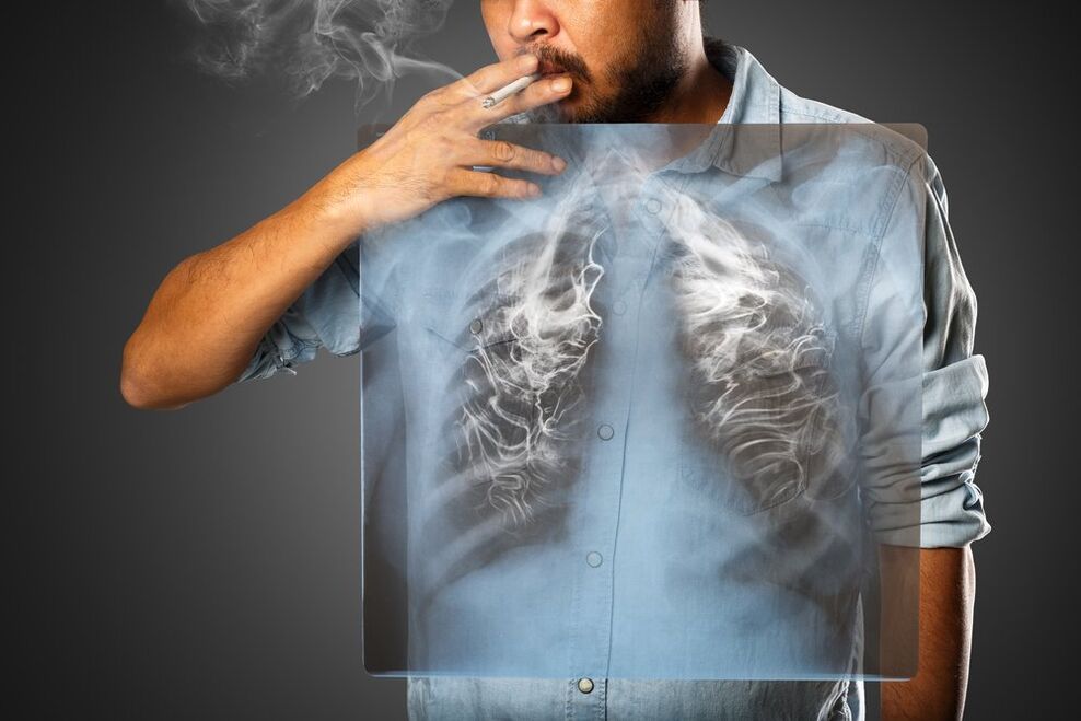 Το κάπνισμα έχει αρνητικές επιπτώσεις στο ανθρώπινο σώμα